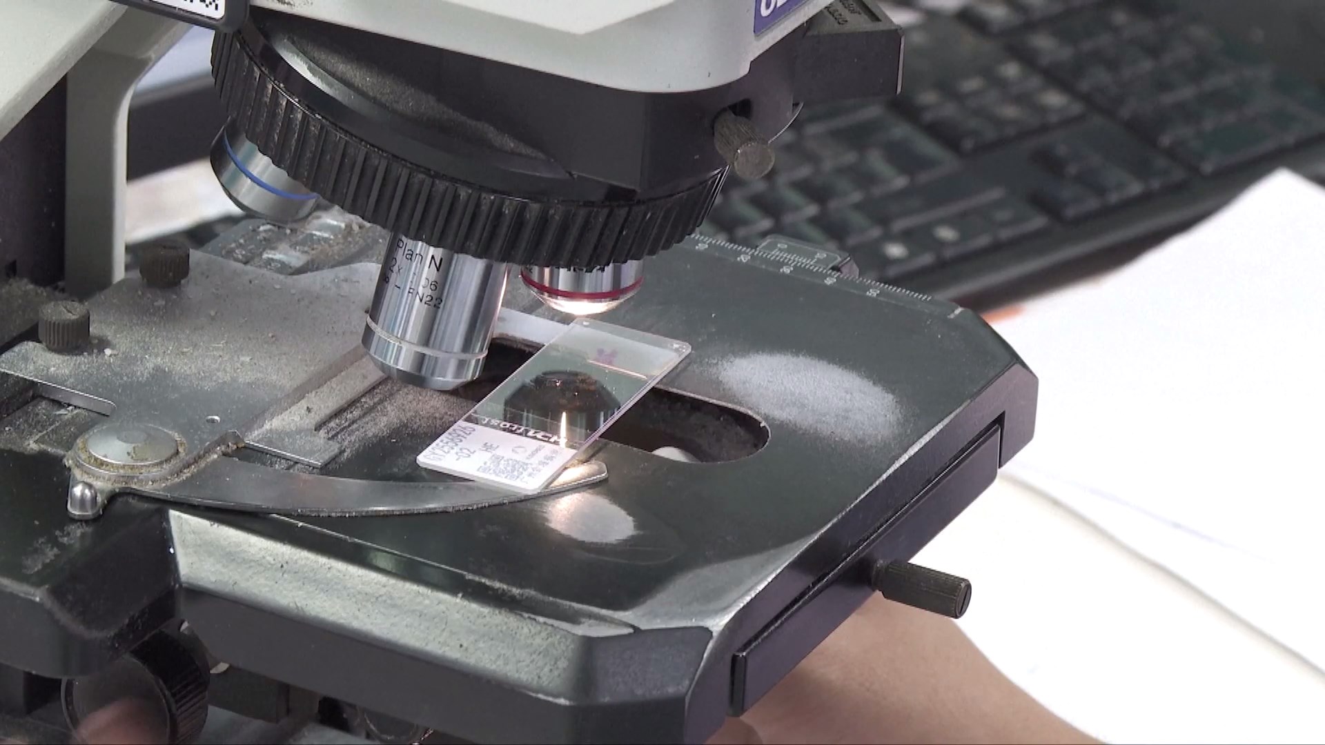 Rumah Sakit di Tiongkok Meluncurkan Model AI Canggih dengan Kemampuan Pengujian Mutasi Gen dalam Waktu Kurang dari 60 Detik